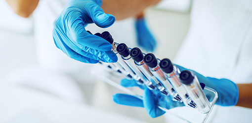 Mekalasi | compact case