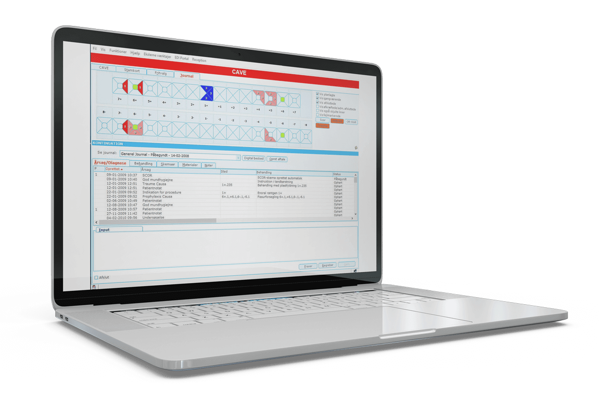 Solteq Tooth - User interface of dental system for handling records and all patient-oriented administrative tasks in a laptop screen